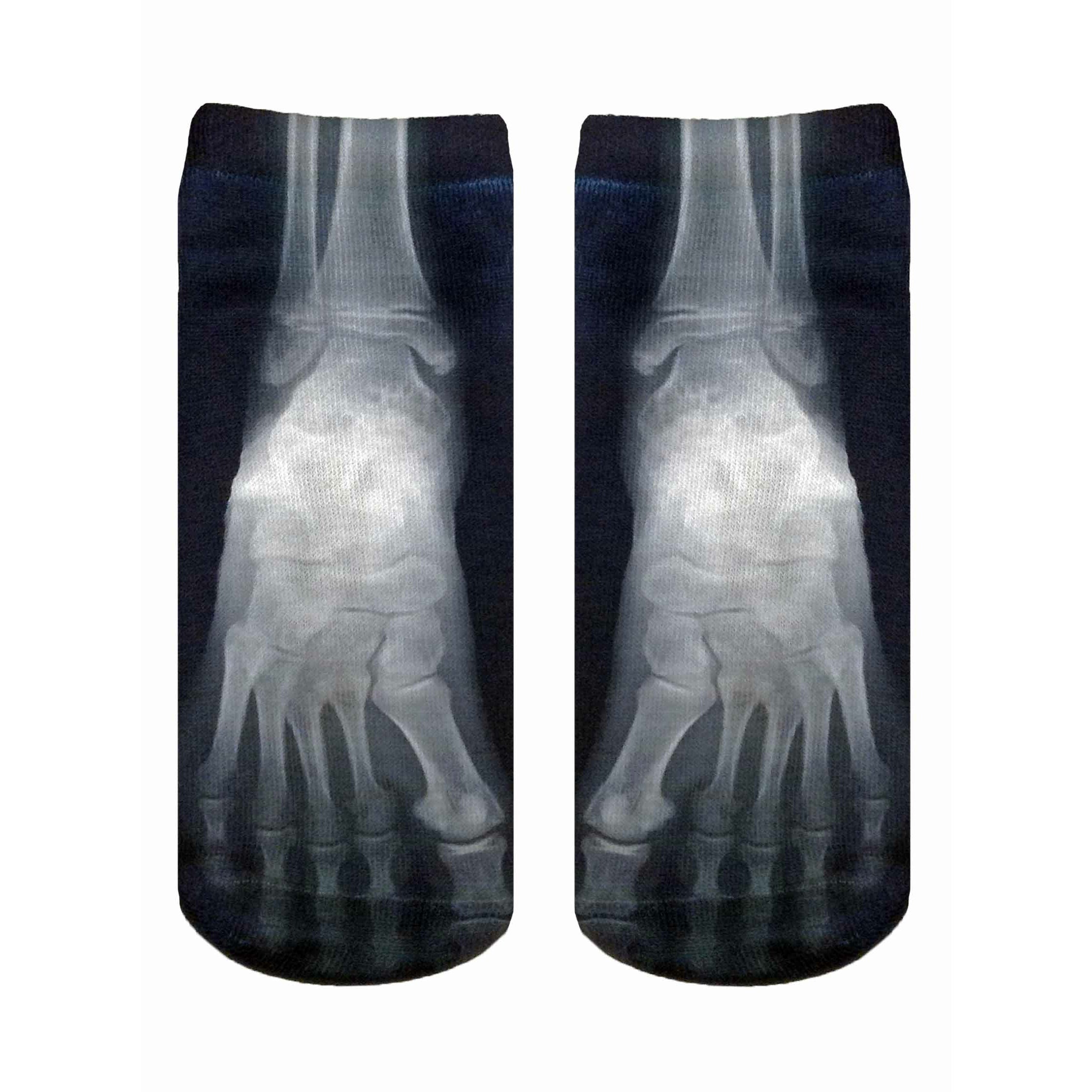 X-Ray